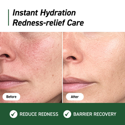 IVOSKIN Cica Redness Relief Treatment Cream